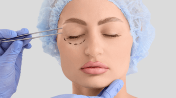 What Is Eyelid Surgery (Blepharoplasty)? Eye Area Rejuvenation