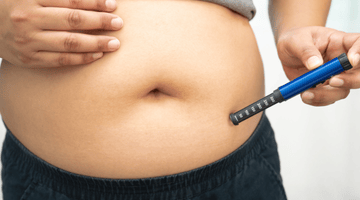 What Is Fat Grafting? A Natural Aesthetic Solution for Volume and Shaping