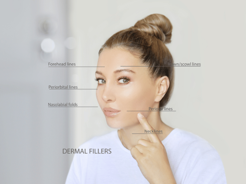 Dermal Fillers