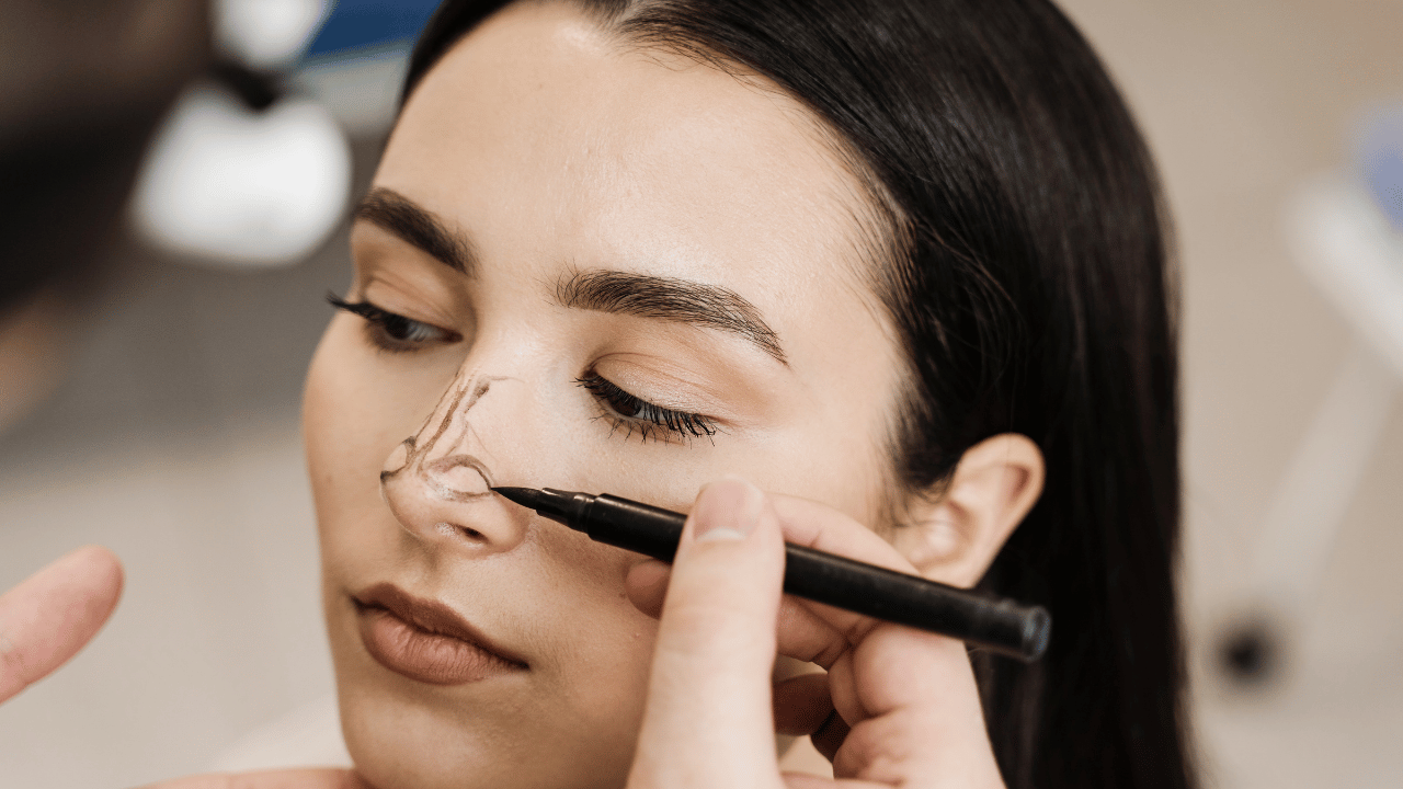 Rhinoplasty – Nose Aesthetic Surgery Guide