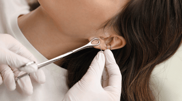 Ear Aesthetics (Otoplasty) What Is It?